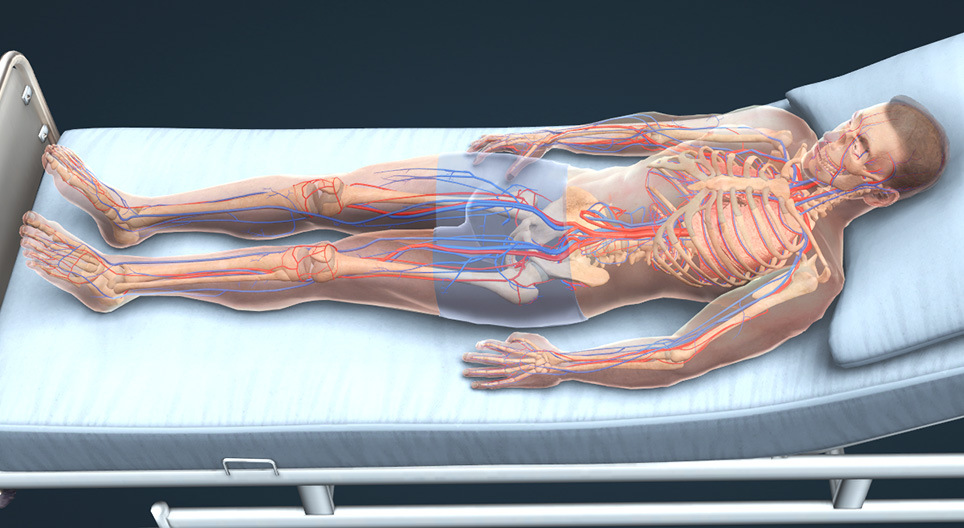 الخثار الوريدي العميق و الإنصمام الرئوي