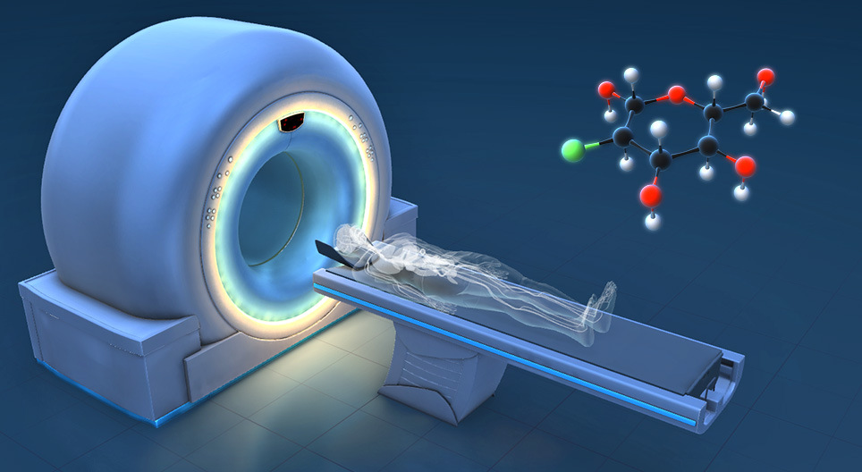 Wie funktioniert die PET/CT?