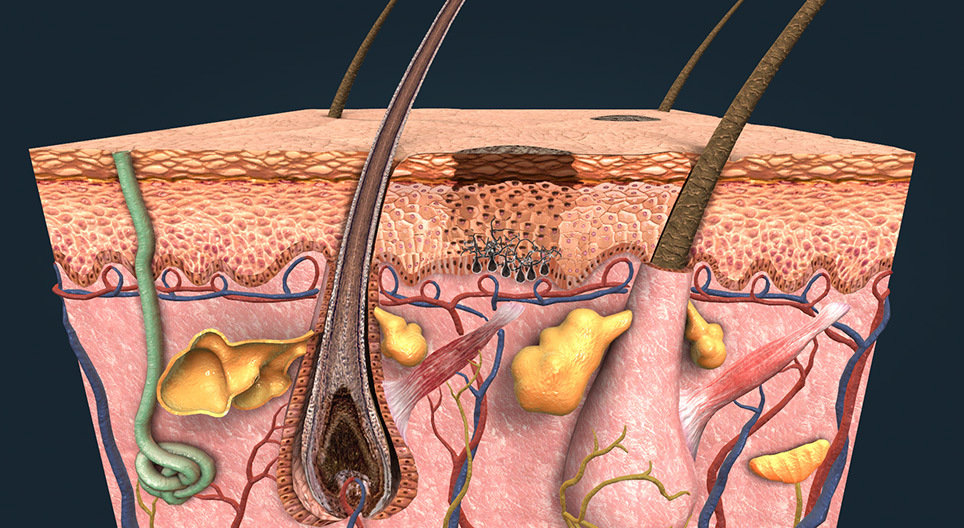 Tanning, skin cancer