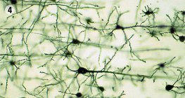 النسيج العصبي