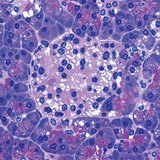 مجموعة خلايا البنكرياس المنتجة للأنزولين