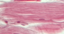 نسيج وتري (مقطع طولي)