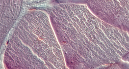 نسيج وتري (مقطع عرضي)