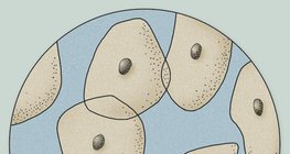 صورة مجهرية عن الخلايا الميلانينية المنفصلة عن اللسان