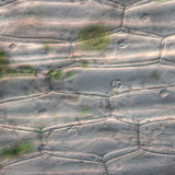 خلايا البشرة النباتية