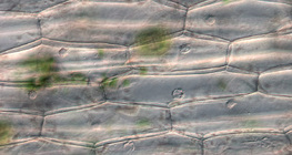 خلايا البشرة النباتية