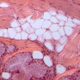 كريات الدم لذبابة الفاكهة (مصبوغة باللون الأحمر) و هي تلتهم البكتيريا (مصبوغة باللون الأخضر)