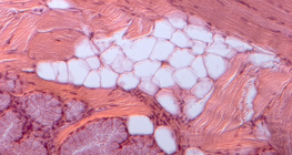 كريات الدم لذبابة الفاكهة (مصبوغة باللون الأحمر) و هي تلتهم البكتيريا (مصبوغة باللون الأخضر)