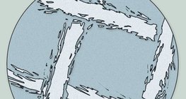 صورة مجهرية للشاش