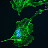 الهيكل الخلوي (في الخلايا الموجودة في رئة الماشية)