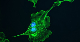 الهيكل الخلوي (في الخلايا الموجودة في رئة الماشية)