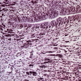 مقطع عرضي في قدم الحلزون