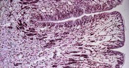 مقطع عرضي في قدم الحلزون