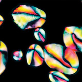 حبيبات النشاء في البطاطا (صورة مستقطبة)