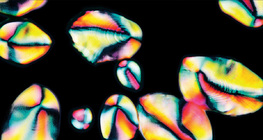 حبيبات النشاء في البطاطا (صورة مستقطبة)