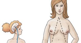 التنظيم الحاثي للبويضات