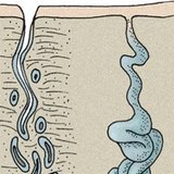 غدد الجلد: غدة عرقية