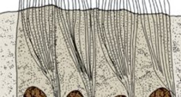 ظهارة مهدبة