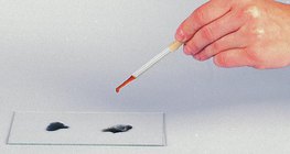 A nyál szerepének vizsgálata 