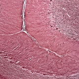 مقطع في المخيخ البشري