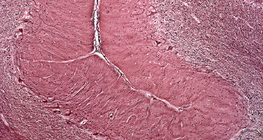 مقطع في المخيخ البشري