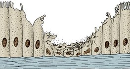 ظهارة هدبية في الجهاز التنفسي لمدخن