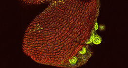 إنفتاح الكيس الطلعي (بواسطة مجهر ليزر ماسح نقطي)