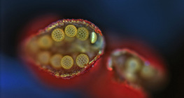 إنفتاح الكيس الطلعي (مجهر ضوئي)