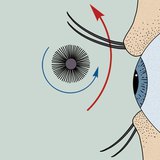 استخدام المسكرة