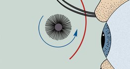 استخدام المسكرة