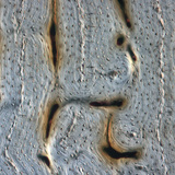 عظم (مقطع طولي)