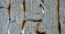 عظم (مقطع طولي)