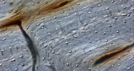 عظم (مقطع طولي)