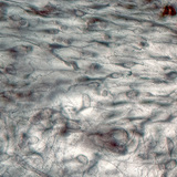 نسيج ليفي لين