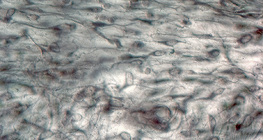 نسيج ليفي لين