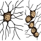 خلايا دبقية