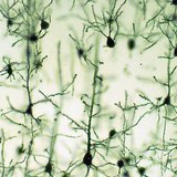 الخلايا العصبية لقشرة المخ