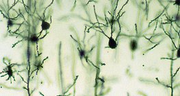 الخلايا العصبية لقشرة المخ