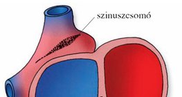 A szív ingerképző és ingerületvezető rendszere