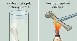 Csontok vizsgálata