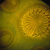 رأس الدودة الشريطية مع وجود خطاف و ممص