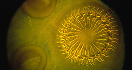 رأس الدودة الشريطية مع وجود خطاف و ممص