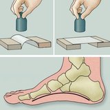 فحص قوس القدم