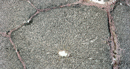 مقطع عرضي في الكبد (خنزير)