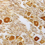 خلايا عصبية في العقدة الشوكية