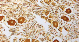 خلايا عصبية في العقدة الشوكية