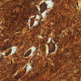 خلايا عصبية في النخاع الشوكي