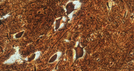 خلايا عصبية في النخاع الشوكي