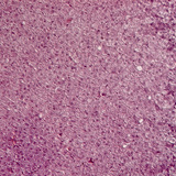 مقطع عرضي في الغدة الكظرية