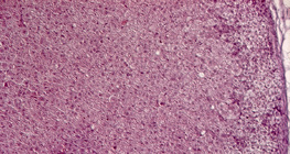 مقطع عرضي في الغدة الكظرية